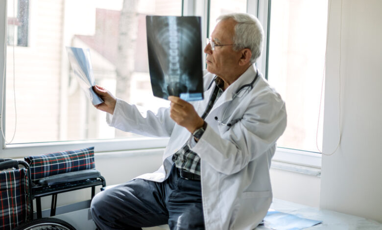 Cáncer de pulmón microcítico: causas, síntomas y tratamientos