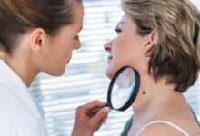 El melanoma es un tipo de cáncer de piel que tiene mayor probabilidad de metástasis. Conoce los principales síntomas factores de riesgo, detección y tratamiento, esto es parte fundamental para sobrellevar la enfermedad.