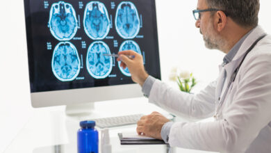 tumor cerebral