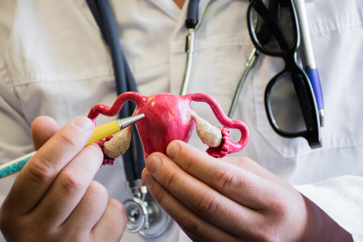 Factores de riesgo del cáncer de ovario