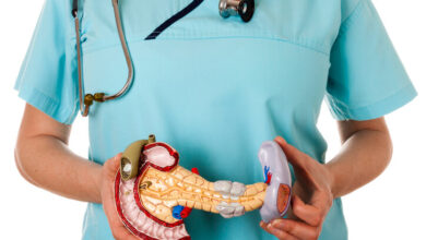 Qué son los tumores del páncreas