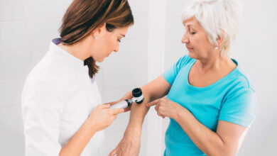 Señales de advertencia del carcinoma epidermoide