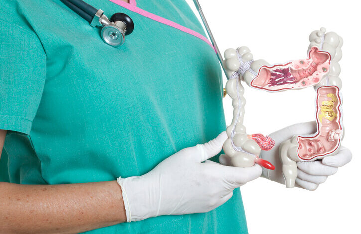 Tratamiento y cura del cáncer colorrectal