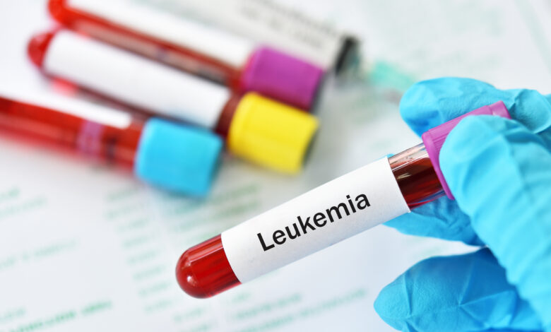 Conoce qué es la leucemia mieloide aguda