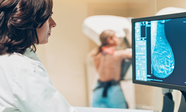 Tipos de cáncer de seno