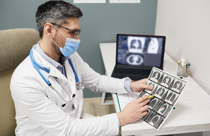 El cáncer de pulmón es un cáncer que se forma en los tejidos del pulmón, generalmente en las células que recubren los conductos de aire.