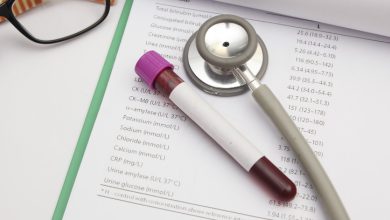 La leucemia se origina en la médula ósea, lugar donde se forman nuevas células sanguíneas.