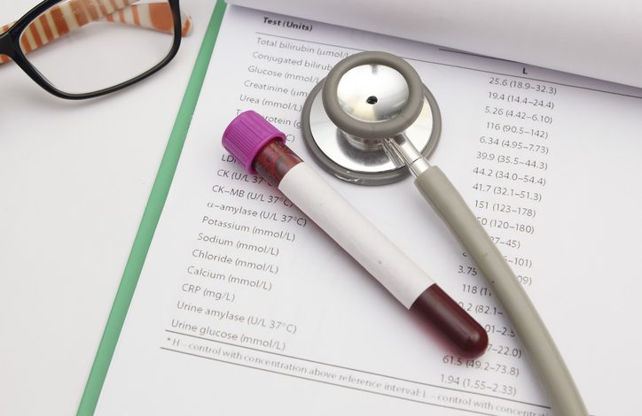 La leucemia se origina en la médula ósea, lugar donde se forman nuevas células sanguíneas.