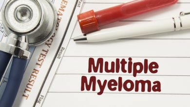 El mieloma es el segundo cáncer de la sangre más frecuente este año, por detrás de los linfomas y los cánceres de los ganglios linfáticos.