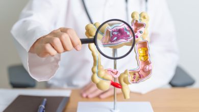 Según la Sociedad Americana Contra El Cáncer (ACS), se proyecta que para el año 2024 habrá aproximadamente 106,590 nuevos casos de cáncer de colon y 46,220 de cáncer rectal en el país.