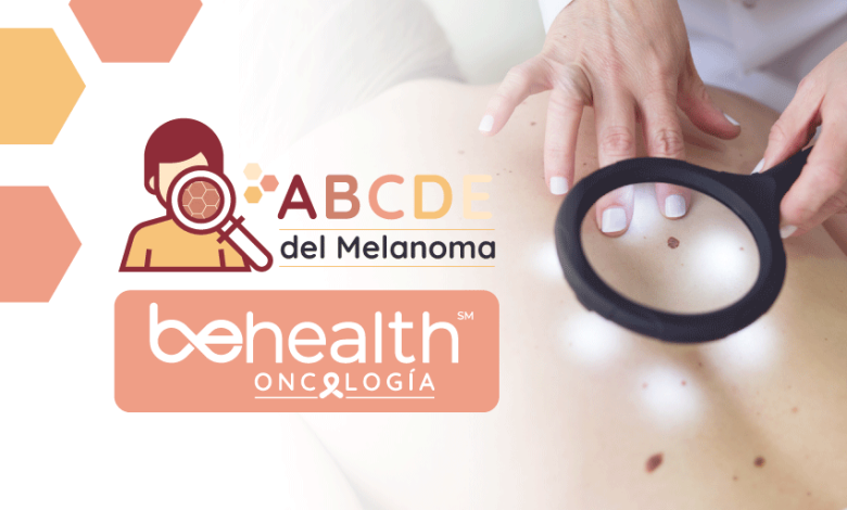 imagen destacada de abcde del melanoma de oncología
