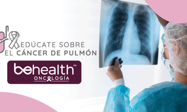 imagen destacada de cáncer de pulmón de oncología actualizada
