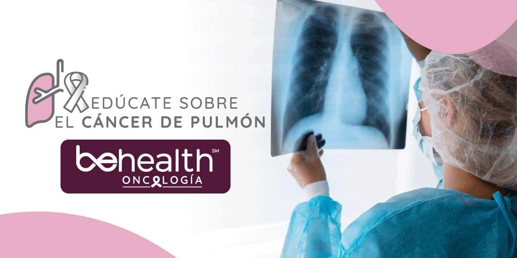 imagen destacada de cáncer de pulmón de oncología actualizada
