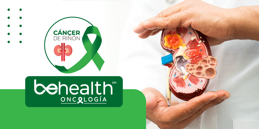 imagen destacada de Cáncer de riñón de oncología actualizada