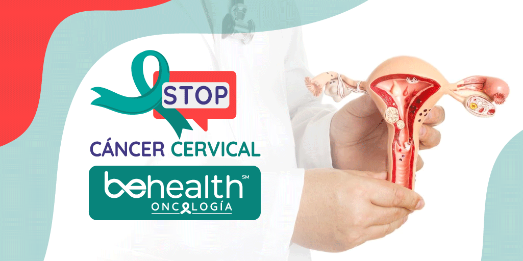 imagen destacada de stop cáncer cervical de oncología actualizada