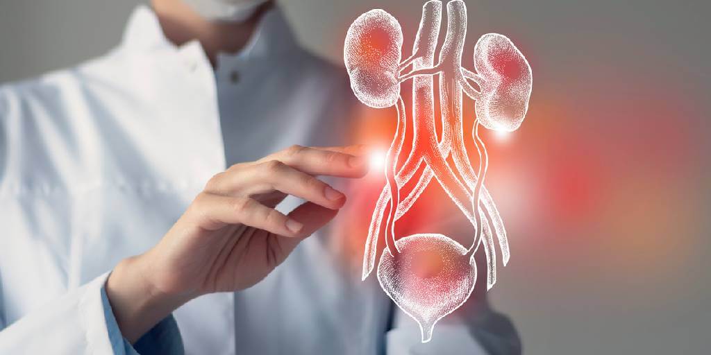 Cáncer de vejiga y colesterol