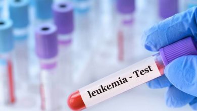 Tratamiento para la leucemia con alta tasa de supervivencia