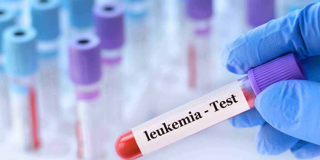 Tratamiento para la leucemia con alta tasa de supervivencia