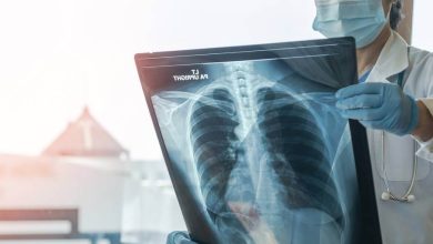 ADN humano devela vínculo entre la contaminación y el cáncer de pulmón entre no fumadores