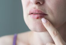 El virus del herpes está siendo modificado por científicos para convertirse en un poderoso aliado en la lucha contra el cáncer