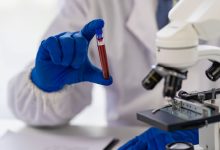 Pruebas de sangre y cáncer