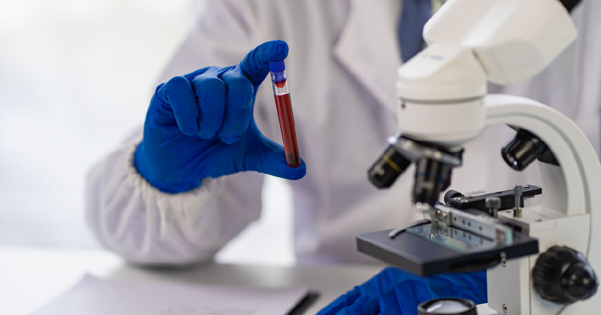 Pruebas de sangre y cáncer