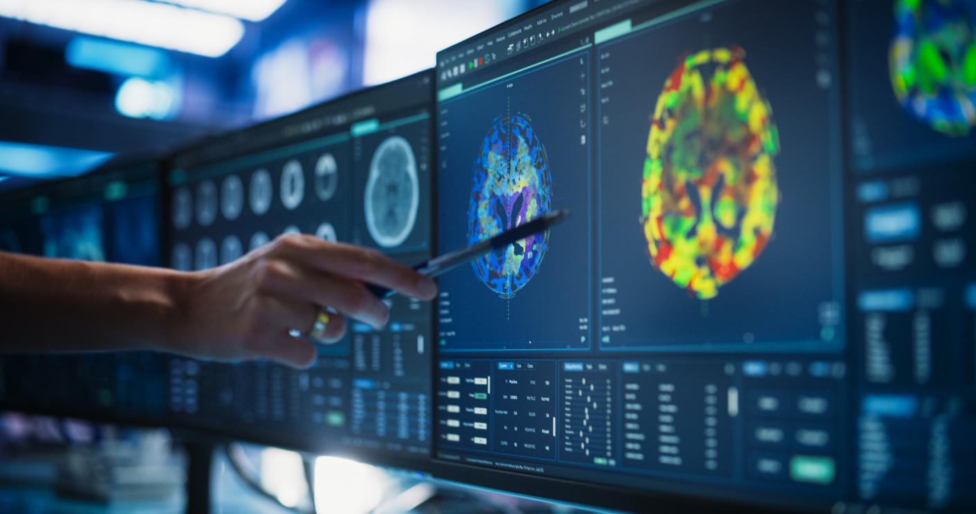 Nuevas terapias ofrecen esperanza en el tratamiento del cáncer cerebral