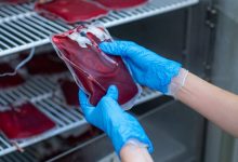 Eliminan VIH de hombre diagnosticado con leucemia tras trasplante de células madre