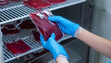 Eliminan VIH de hombre diagnosticado con leucemia tras trasplante de células madre