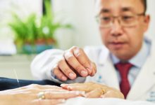 Resaltan efectos de la acupuntura en las dificultades cognitivas relacionadas con el cáncer