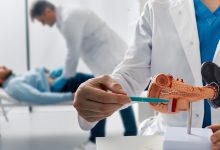 Científicos españoles logran eliminar el cáncer de páncreas en fase experimental con una terapia triple