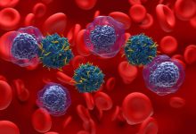 Un equipo de diferentes científicos ha dado un paso clave frente a la personalización del tratamiento de la leucemia mieloide aguda.