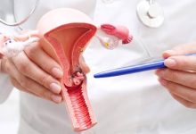 El CCCUPR invita a mujeres entre los 25 y 65 años de Puerto Rico y que no estén al día con sus pruebas para la prevención de cáncer cervical.