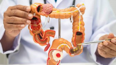 Una preocupación inminente entre la comunidad médica y oncológica sobre el aumento de muertes por cáncer rectal en pacientes jóvenes.