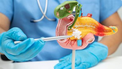La Sociedad Americana Contra el Cáncer estima que en 2026 el cáncer de páncreas en Estados Unidos será de 67,530 personas diagnosticadas.