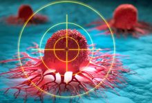 Un grupo de investigadores italianos bajo identificaron una proteína (p62) que podría ser fundamental en el tratamiento contra el cáncer.