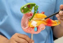 Un grupo de expertos ha logrado realizar una vacuna experimental para prevenir el cáncer de páncreas en individuos de alto riesgo.
