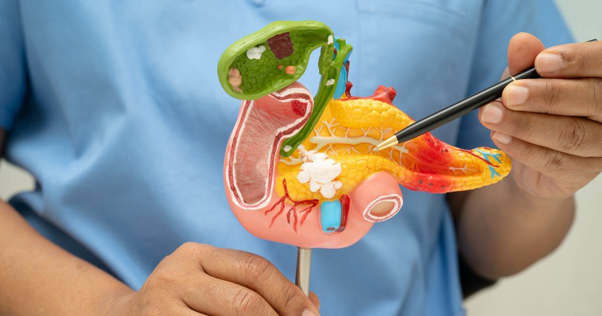 Un grupo de expertos ha logrado realizar una vacuna experimental para prevenir el cáncer de páncreas en individuos de alto riesgo.