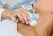 Los nódulos en la tiroides son bultos sólidos o llenos de líquido que se forman dentro de la tiroides. Solo un porcentaje pueden ser cáncer.